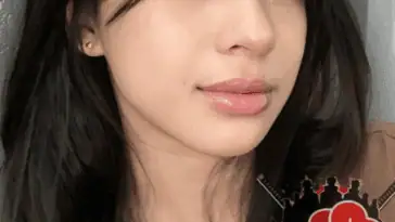 Lynini 1
